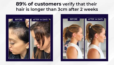 🌿Last day offer – 50% off🌿 HZA™ Hair Growth Spray, pure natural plant extracts without chemical additives