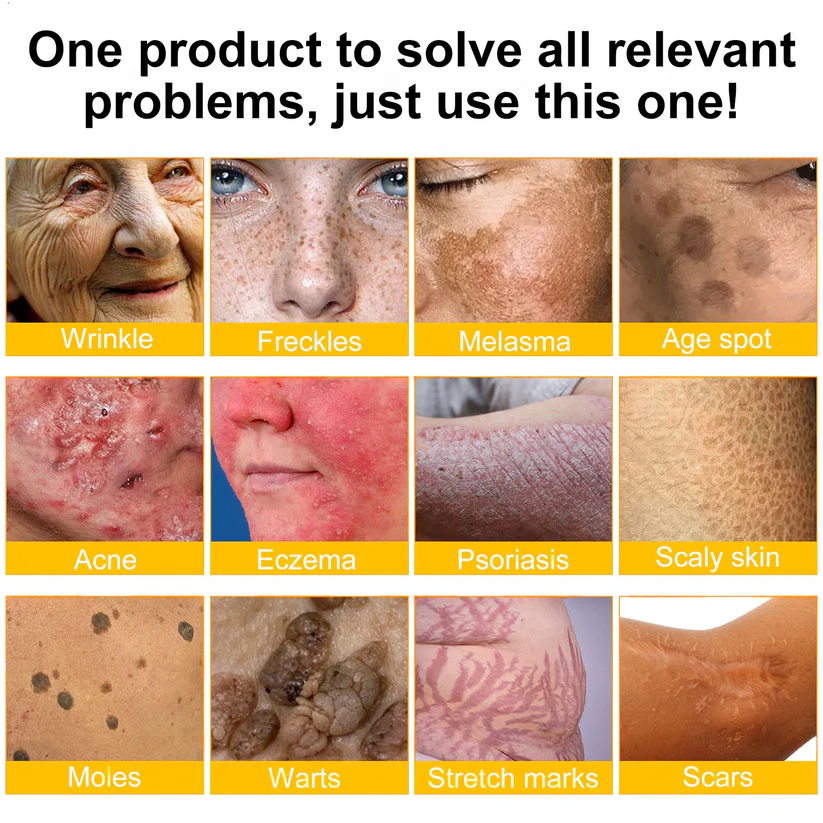 🔥FDA Approved: Bee Venom Skin Restoration Cream — 🔥Limited Time 80% OFF🔥