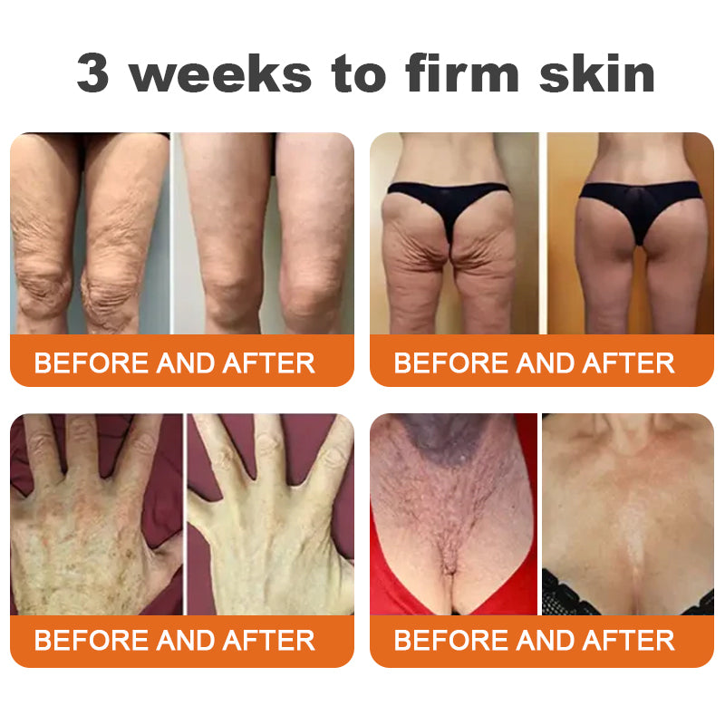 đđFlysmus⢠Botox Bee Venom Firming Serum Stick â (Hergestellt und versendet in Germany) â LETZTER TAG 70 % RABATT