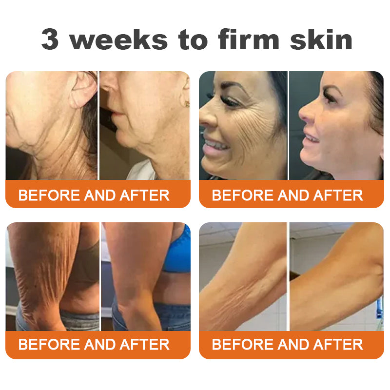 đđFlysmus⢠Botox Bee Venom Firming Serum Stick â (Hergestellt und versendet in Germany) â LETZTER TAG 70 % RABATT