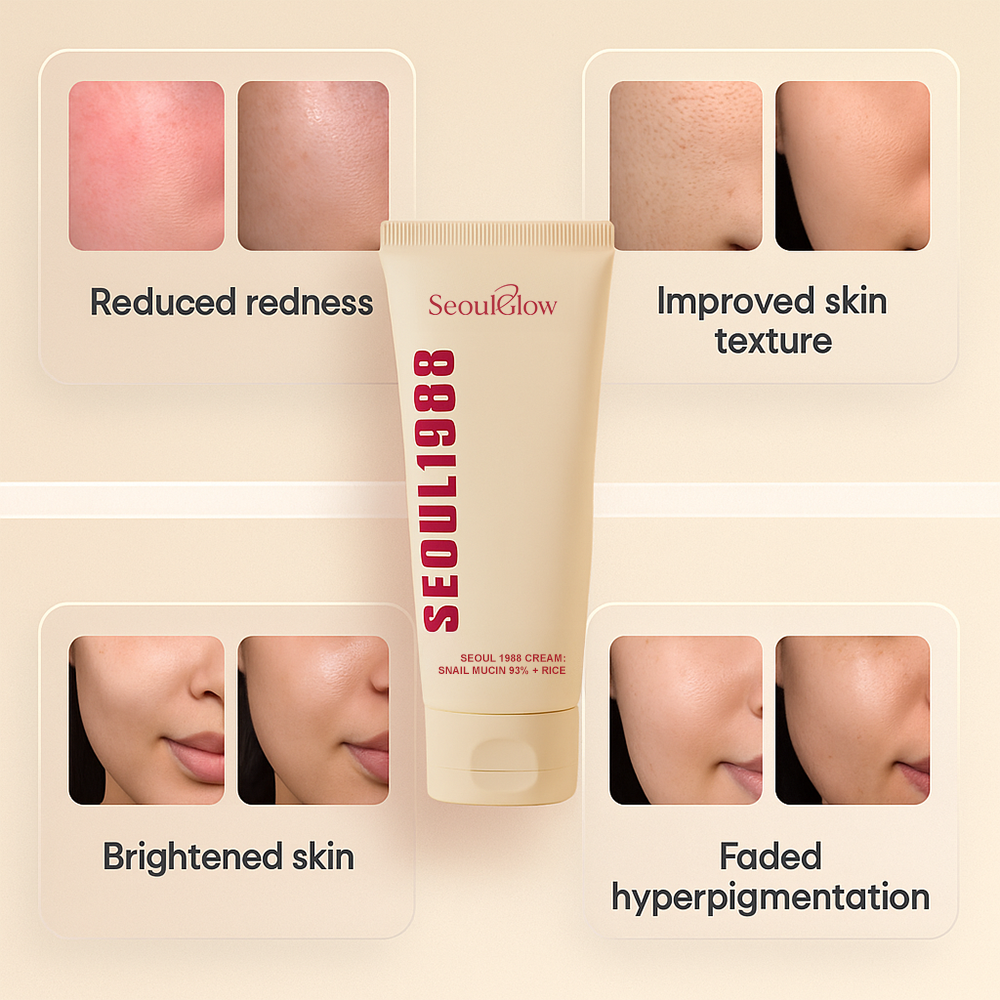 🔬Seoul1988™ - 🐌Cream : Snail Mucin 97%🧪 + Rice🌾