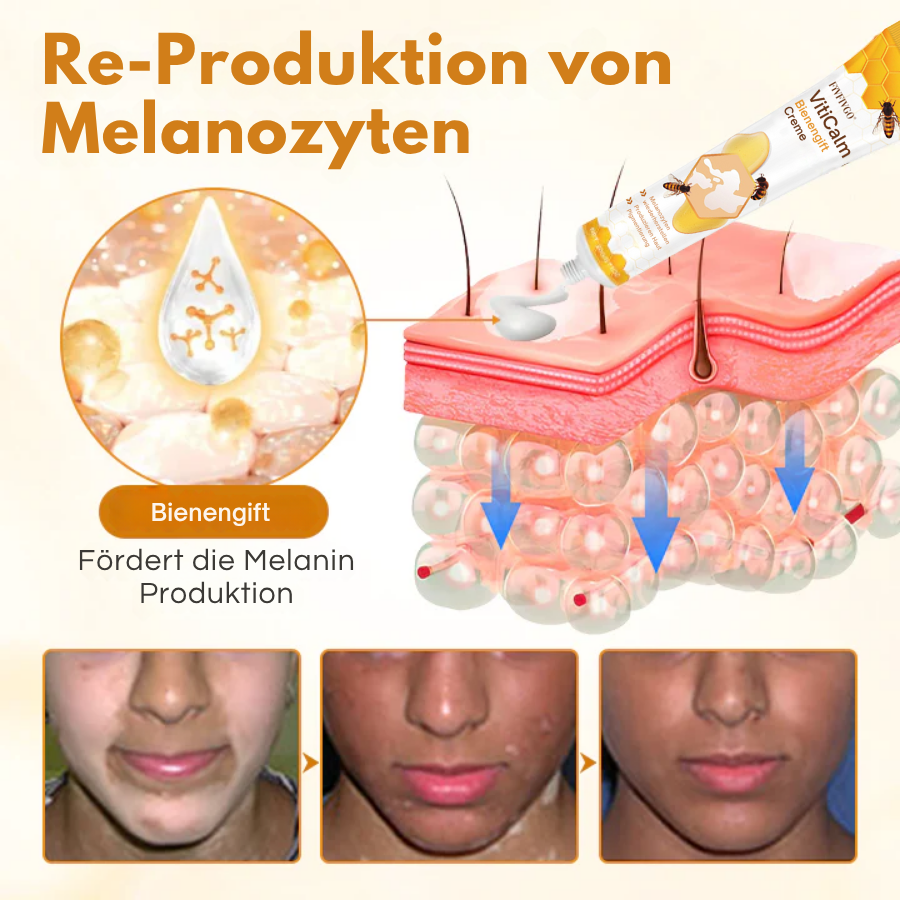 Fivfivgo® VitiCalm Bienengift-Creme,✔️95% Sichtbare Verbesserung In 4 Wochen ,Fördert Pigmentierung & Stellt Natürlichen Hautton Wieder Her