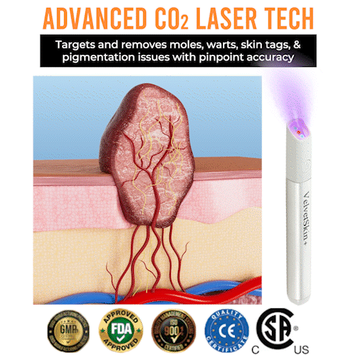 ☂DerMultak® VelvetSkin+Special 🥇All-in-One Laser Eraser Pen🖊️(🛸Powered by CO₂ laser technology – effectively removes moles, warts, skin tags, pigmentation spots, and other skin imperfections)