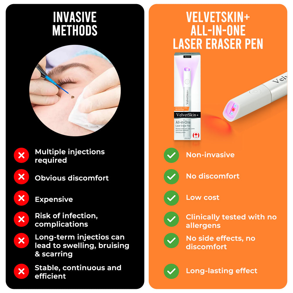 ☂DerMultak® VelvetSkin+Special 🥇All-in-One Laser Eraser Pen🖊️(🛸Powered by CO₂ laser technology – effectively removes moles, warts, skin tags, pigmentation spots, and other skin imperfections)