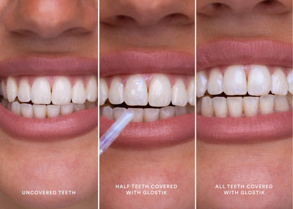 🔥Jetzt 40% Rabatt🎁 - Glostik PAP+ Reihe Tooth Gloss – 🦷Strahlend Weiße Zähne in Minuten! 🌿Natürlich & Effektiv-Perfektes Lächeln mit Glanz，Zahnglanz Revolution für Dich。