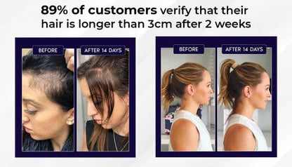 🌿Last day offer – 50% off🌿 HZA™ Hair Growth Spray, pure natural plant extracts without chemical additives