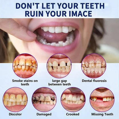 🦷Hermsa® Multi-Functional ThermoFlex Silicone Denture Set  – For Eating, Smiling, and Daily Comfort😁