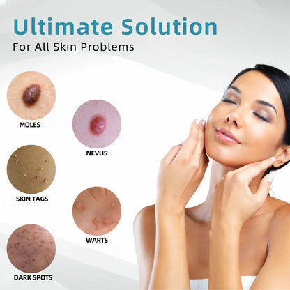 ☂DerMultak® VelvetSkin+Special 🥇All-in-One Laser Eraser Pen🖊️(🛸Powered by CO₂ laser technology – effectively removes moles, warts, skin tags, pigmentation spots, and other skin imperfections)