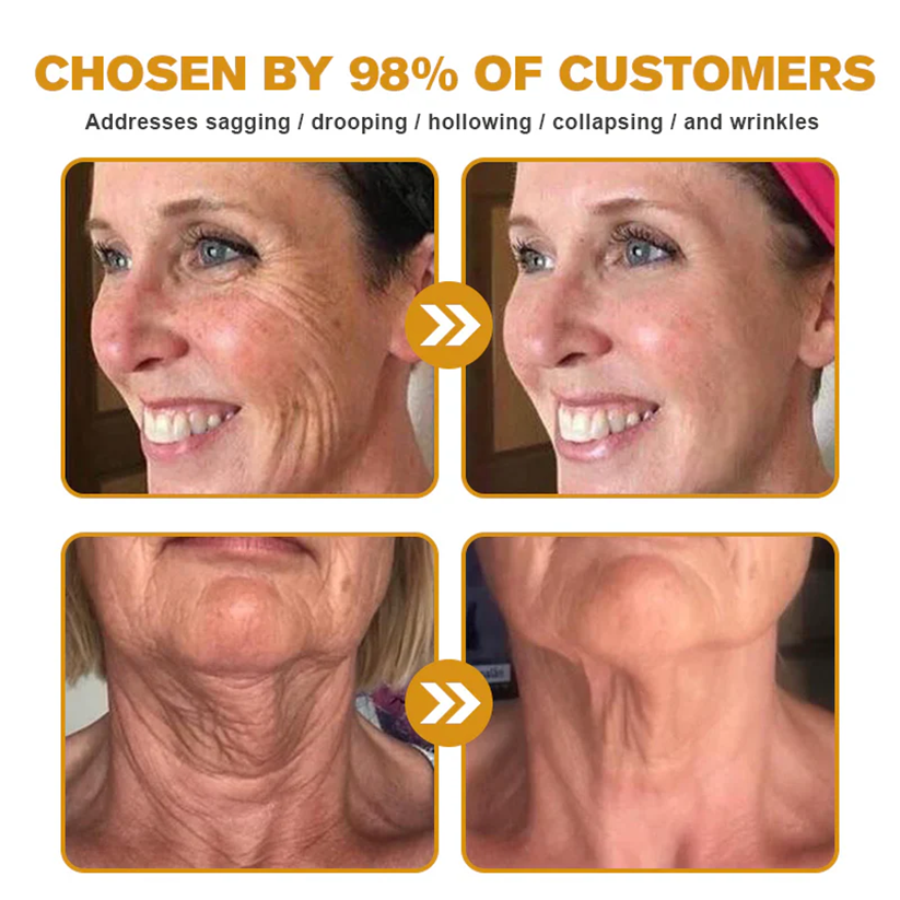 🔥FDA Approved:  Bee Venom Skin Restoration Cream — 🔥Limited Time 80% OFF🔥