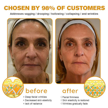 👨‍⚕️ Made and shipped from the USA✅ Botox Bee Venom Wrinkle Cream – Last Day 80% Off