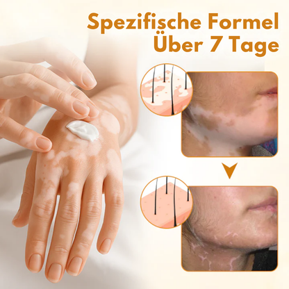 Fivfivgo® VitiCalm Bienengift-Creme，✔️95% Sichtbare Verbesserung In 4 Wochen ，Fördert Pigmentierung & Stellt Natürlichen Hautton Wieder Her