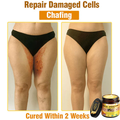 🔥FDA Approved:  Bee Venom Skin Restoration Cream — 🔥Limited Time 80% OFF🔥