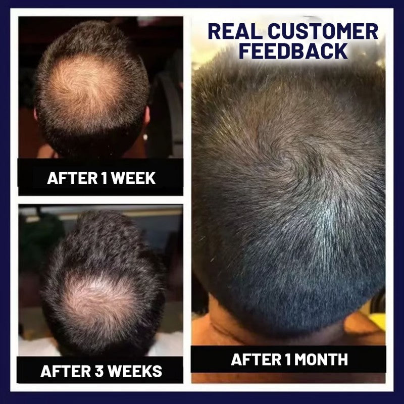 🌿Last day offer – 50% off🌿 HZA™ Hair Growth Spray, pure natural plant extracts without chemical additives