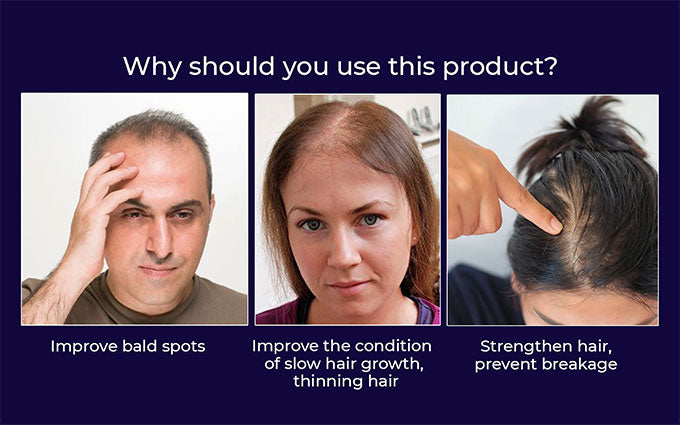 🌿Last day offer – 50% off🌿 HZA™ Hair Growth Spray, pure natural plant extracts without chemical additives