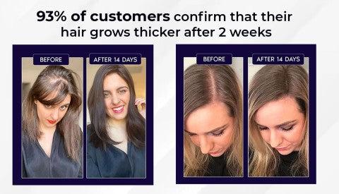 🌿Last day offer – 50% off🌿 HZA™ Hair Growth Spray, pure natural plant extracts without chemical additives