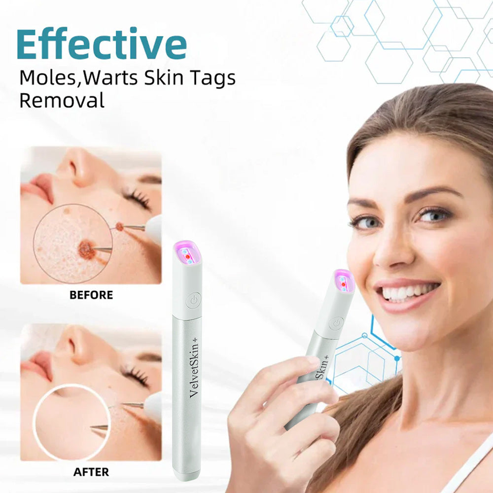 ☂DerMultak® VelvetSkin+Special 🥇All-in-One Laser Eraser Pen🖊️(🛸Powered by CO₂ laser technology – effectively removes moles, warts, skin tags, pigmentation spots, and other skin imperfections)