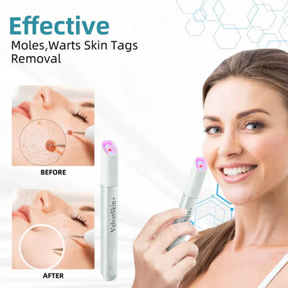 ☂DerMultak® VelvetSkin+Special 🥇All-in-One Laser Eraser Pen🖊️(🛸Powered by CO₂ laser technology – effectively removes moles, warts, skin tags, pigmentation spots, and other skin imperfections)