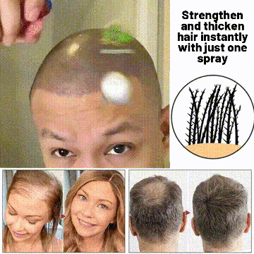 🌿Last day offer – 50% off🌿 HZA™ Hair Growth Spray, pure natural plant extracts without chemical additives